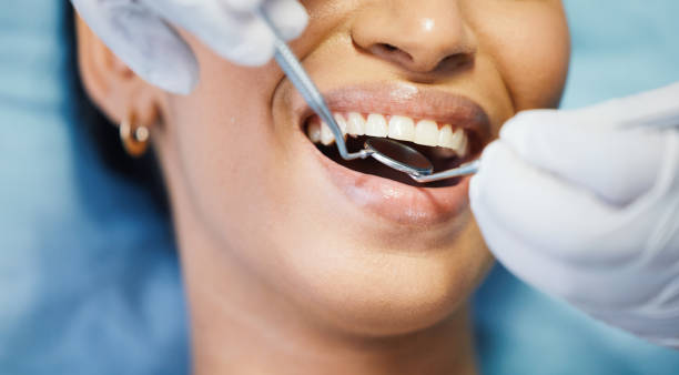 Best Walk-In Emergency Dentist in Saw Creek, PA
